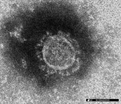 사진은 코로나 바이러스의 현미경 모습